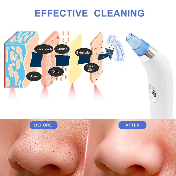 Acne Pore Cleaning Electric Facial Beauty Instrument Blackhead Suction Instrument